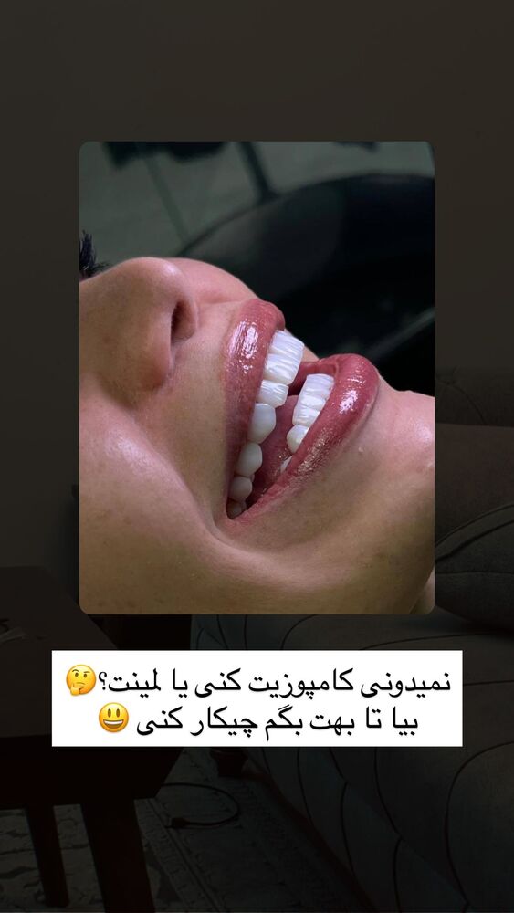  جدید ترین استوری اینستاگرام خود فاطی