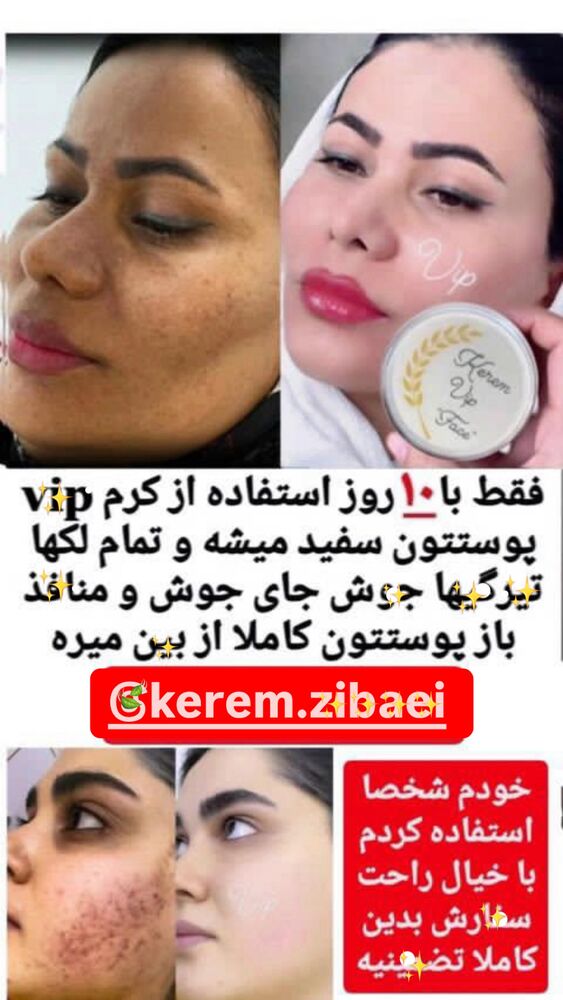  جدید ترین استوری اینستاگرام لادن