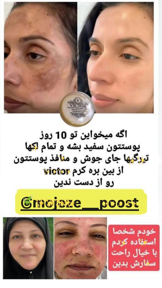  جدید ترین استوری اینستاگرام لادن
