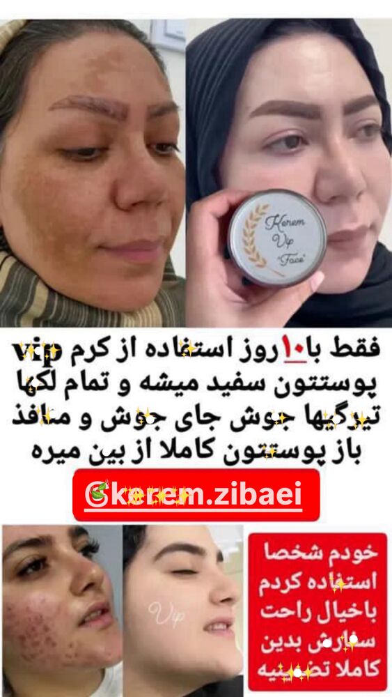  جدید ترین استوری اینستاگرام لادن