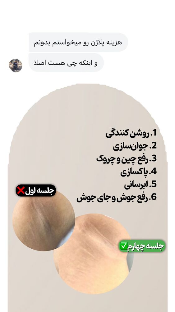  جدید ترین استوری اینستاگرام الناز شمی