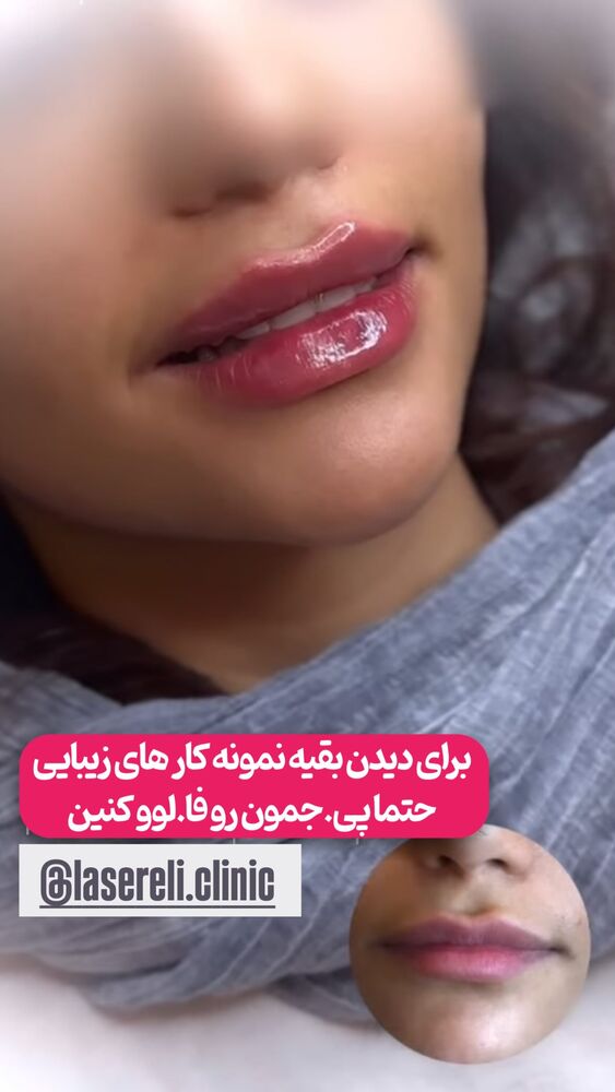  جدید ترین استوری اینستاگرام الناز شمی