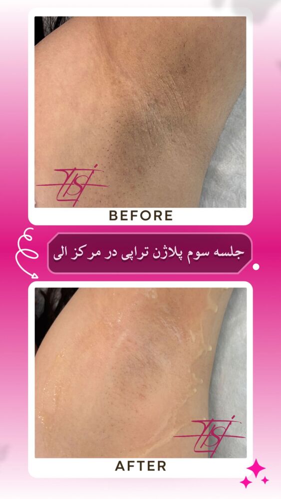  جدید ترین استوری اینستاگرام الناز شمی