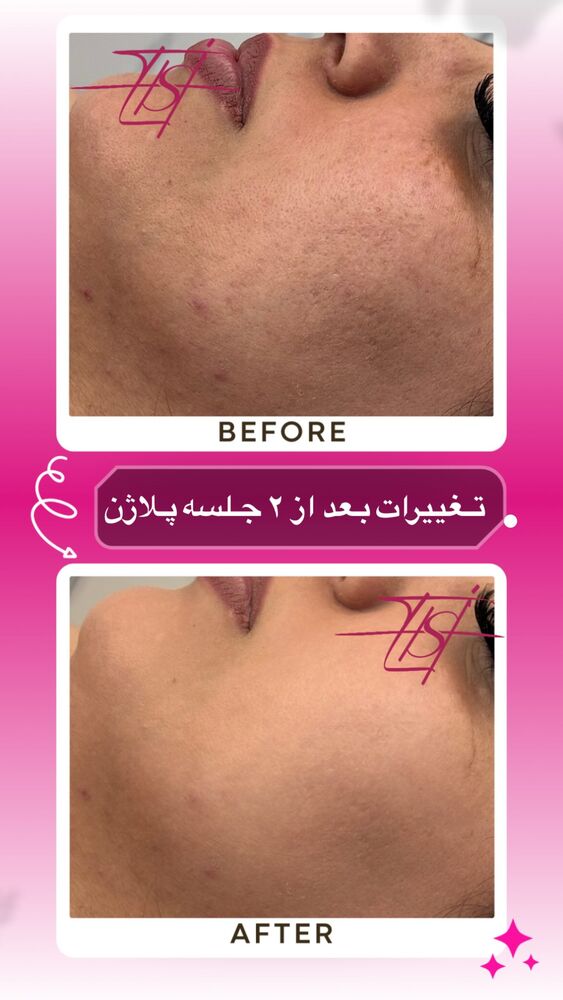  جدید ترین استوری اینستاگرام الناز شمی