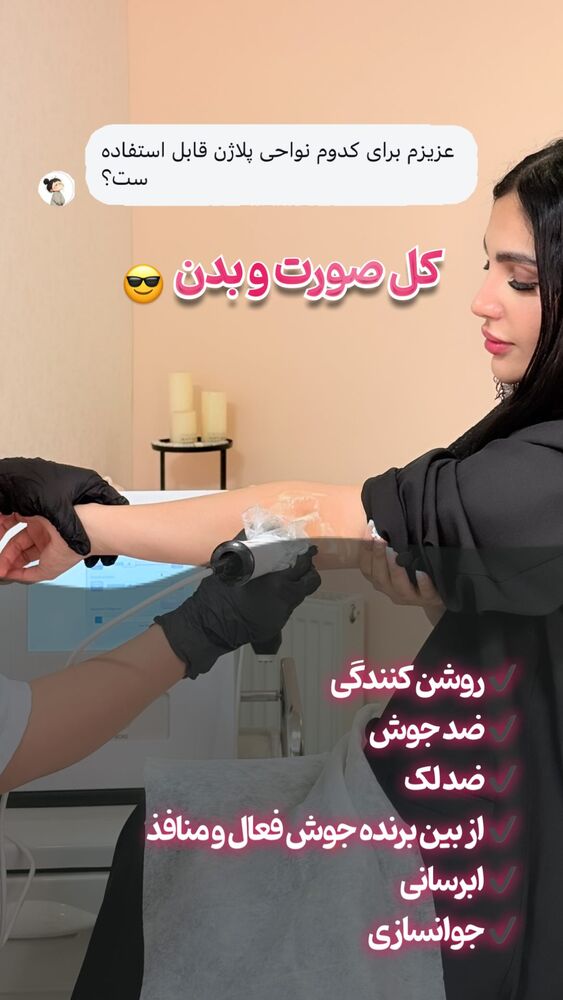  جدید ترین استوری اینستاگرام الناز شمی