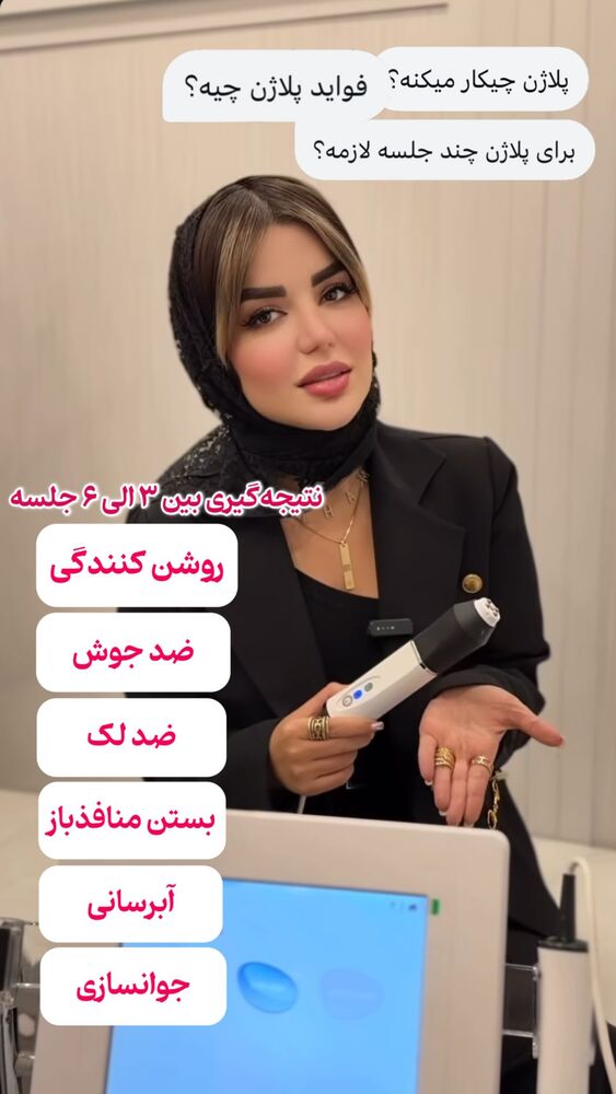  جدید ترین استوری اینستاگرام الناز شمی