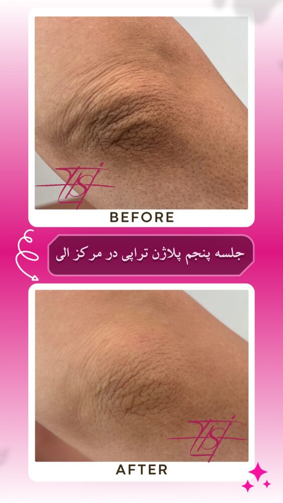  جدید ترین استوری اینستاگرام الناز شمی