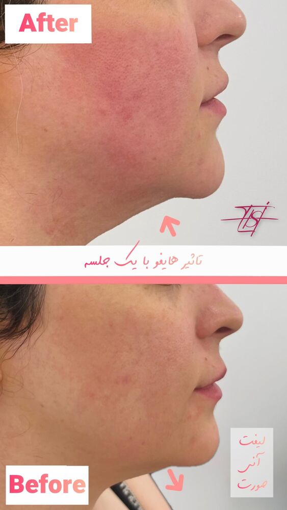  جدید ترین استوری اینستاگرام الناز شمی