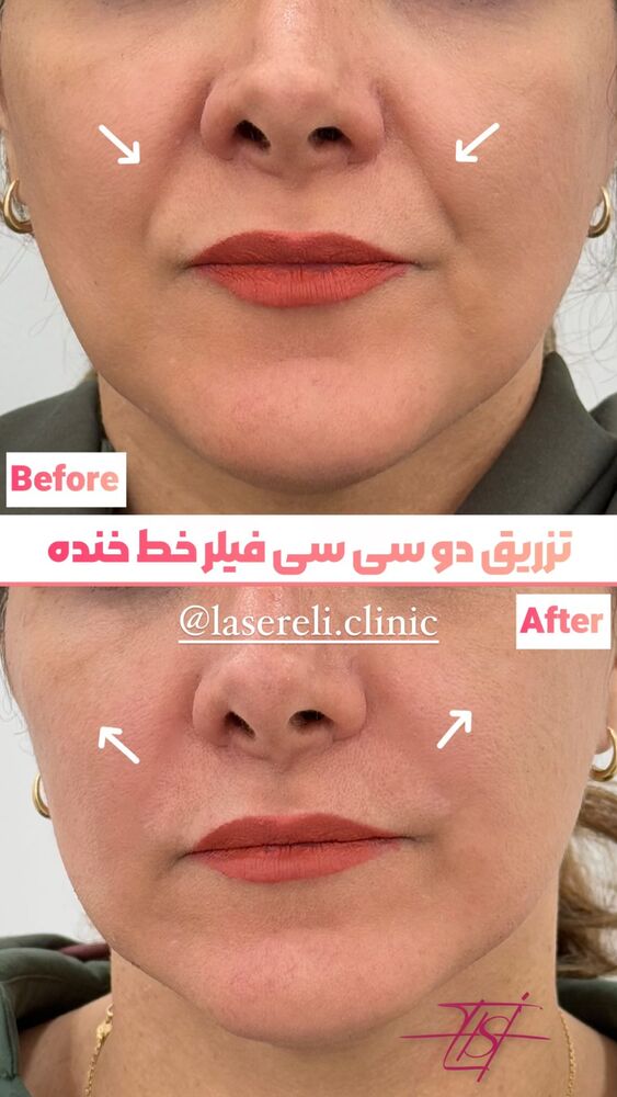  جدید ترین استوری اینستاگرام الناز شمی