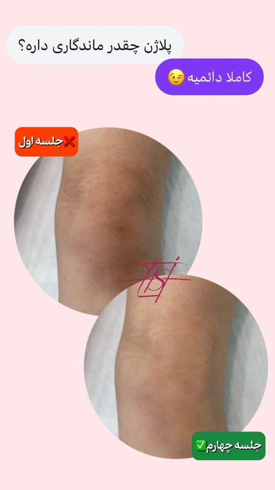  جدید ترین استوری اینستاگرام الناز شمی