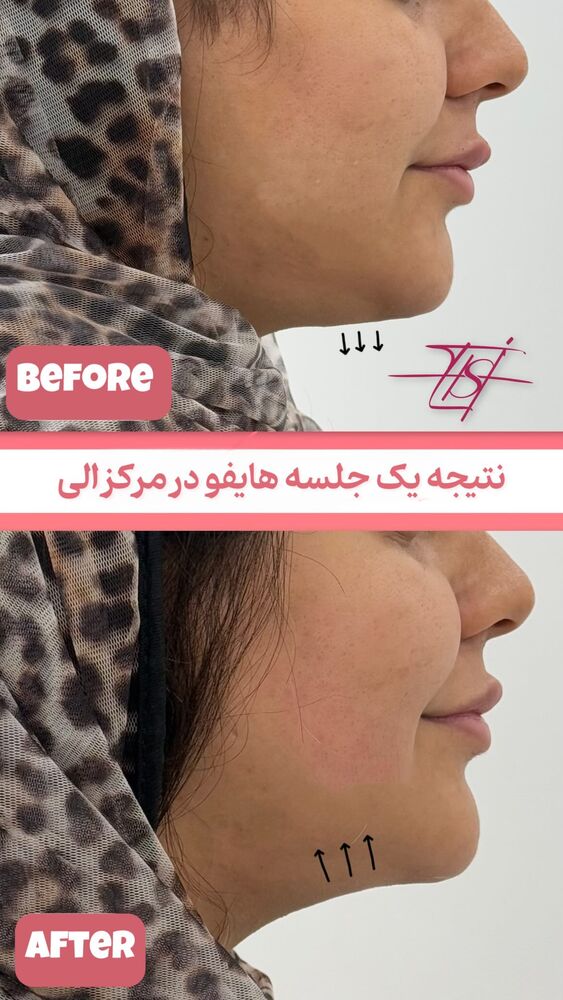  جدید ترین استوری اینستاگرام الناز شمی