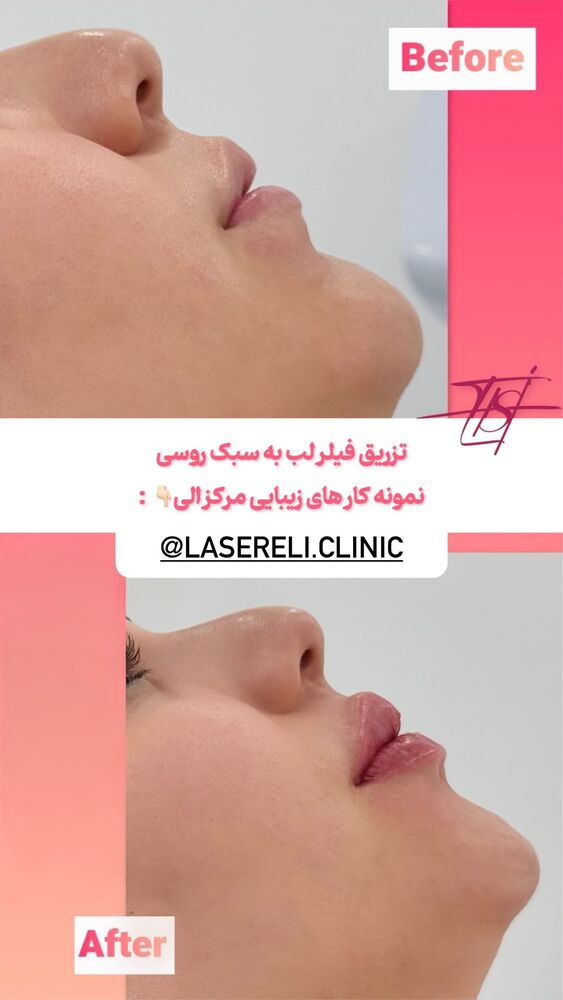  جدید ترین استوری اینستاگرام الناز شمی