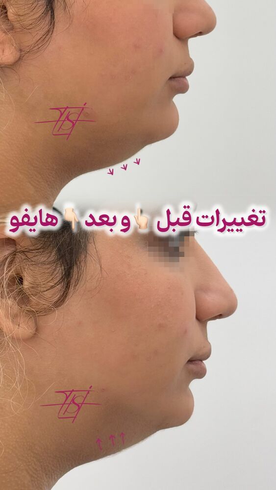  جدید ترین استوری اینستاگرام الناز شمی