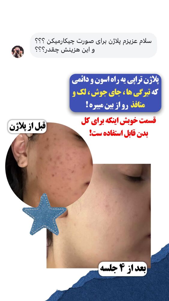  جدید ترین استوری اینستاگرام الناز شمی
