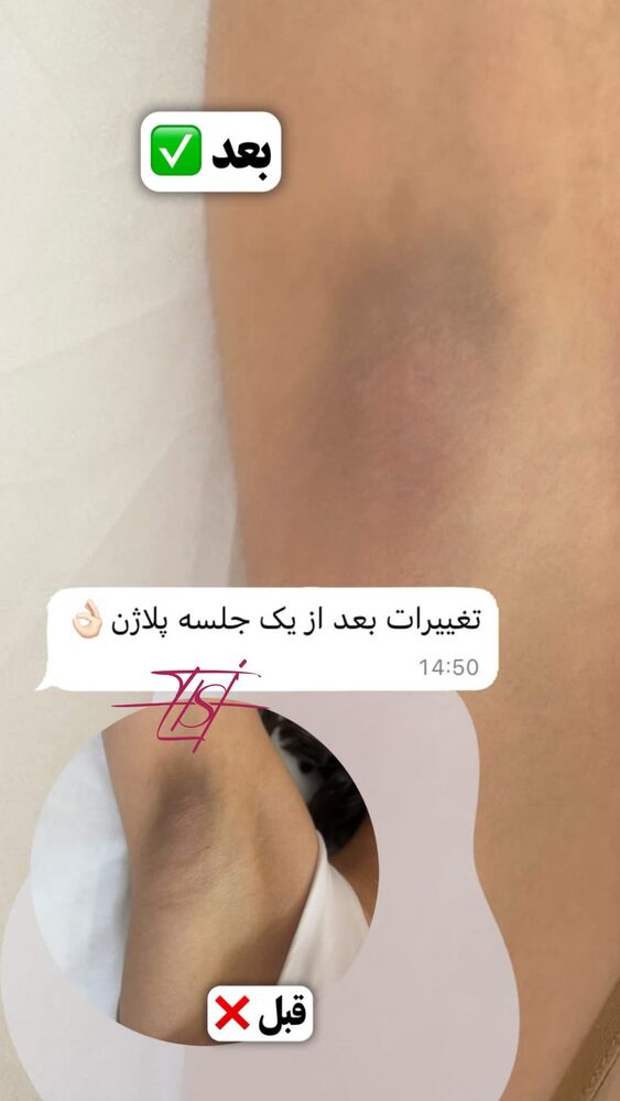  جدید ترین استوری اینستاگرام الناز شمی