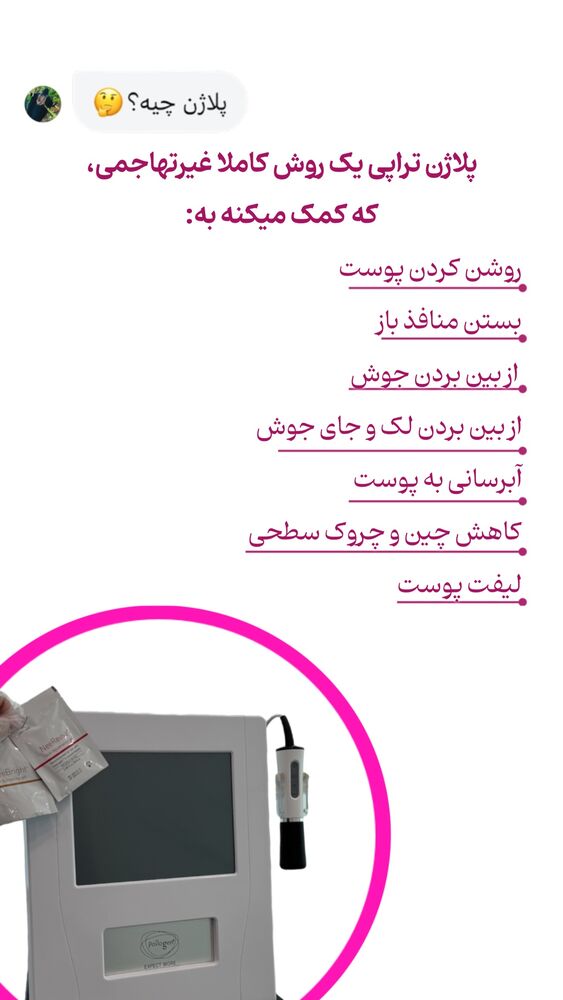  جدید ترین استوری اینستاگرام الناز شمی