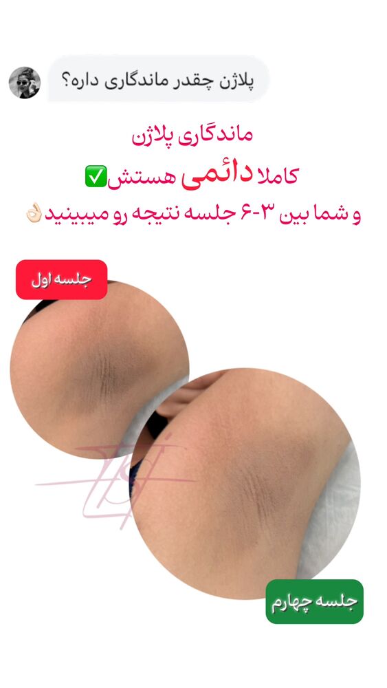  جدید ترین استوری اینستاگرام الناز شمی