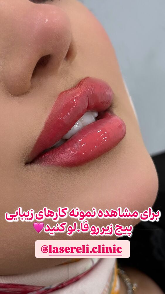  جدید ترین استوری اینستاگرام الناز شمی