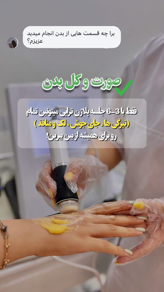  جدید ترین استوری اینستاگرام الناز شمی