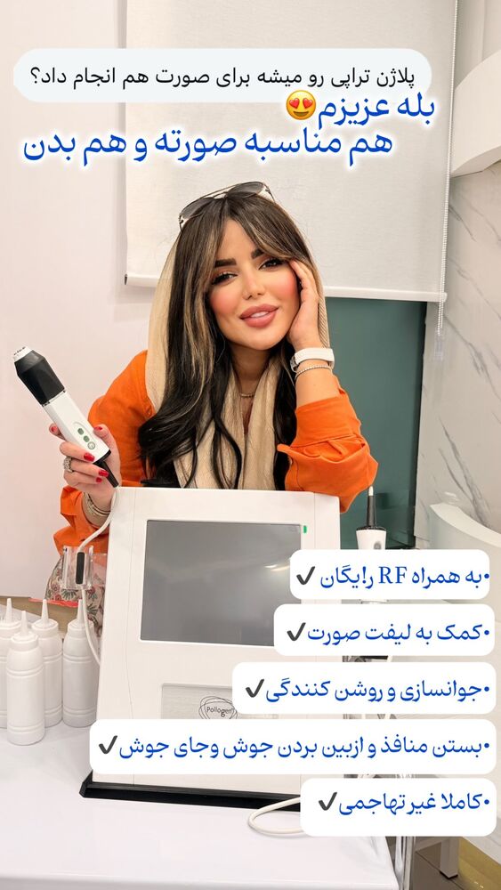  جدید ترین استوری اینستاگرام الناز شمی