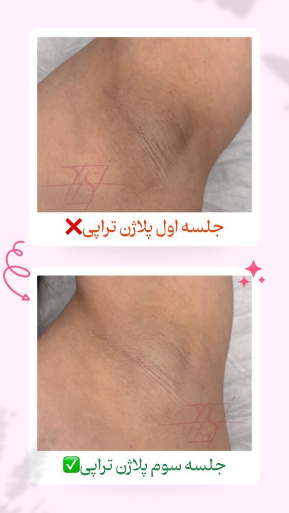  جدید ترین استوری اینستاگرام الناز شمی