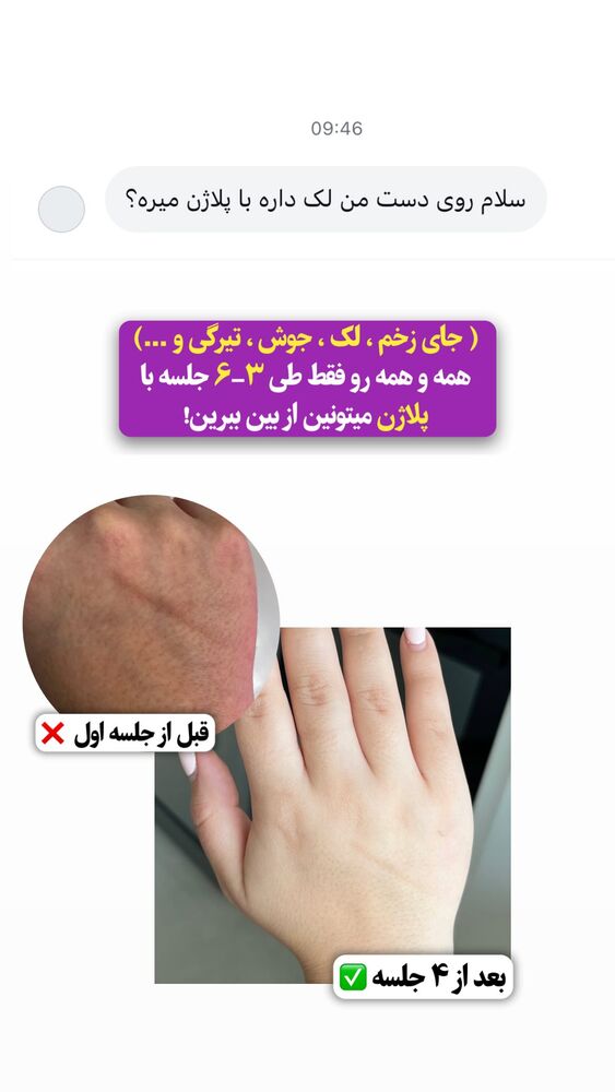  جدید ترین استوری اینستاگرام الناز شمی