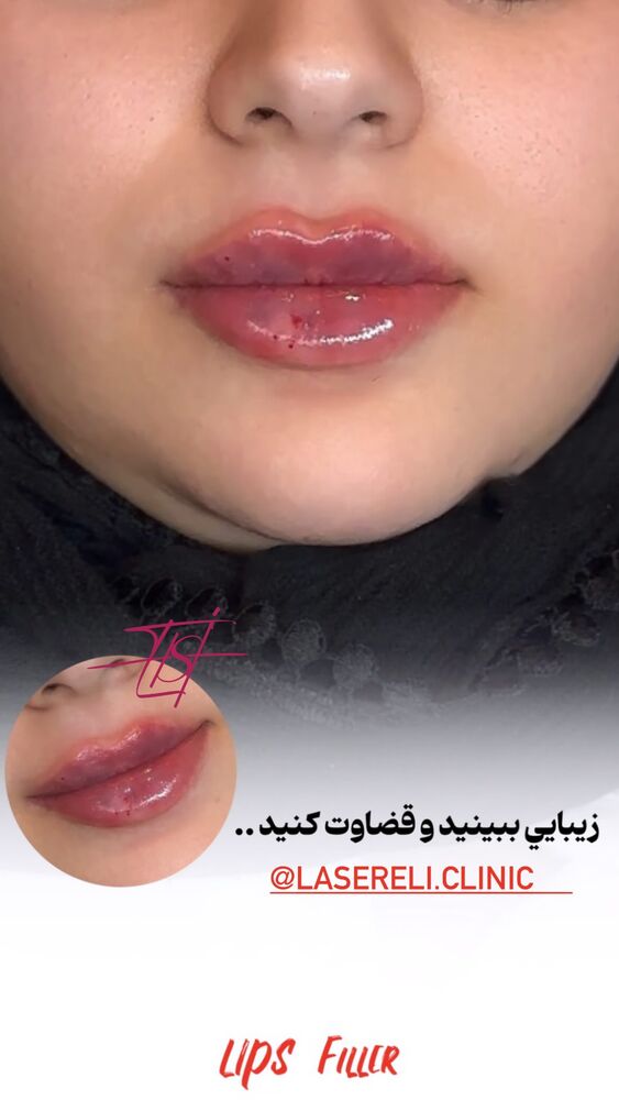  جدید ترین استوری اینستاگرام الناز شمی