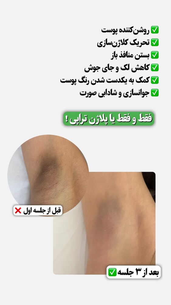  جدید ترین استوری اینستاگرام الناز شمی