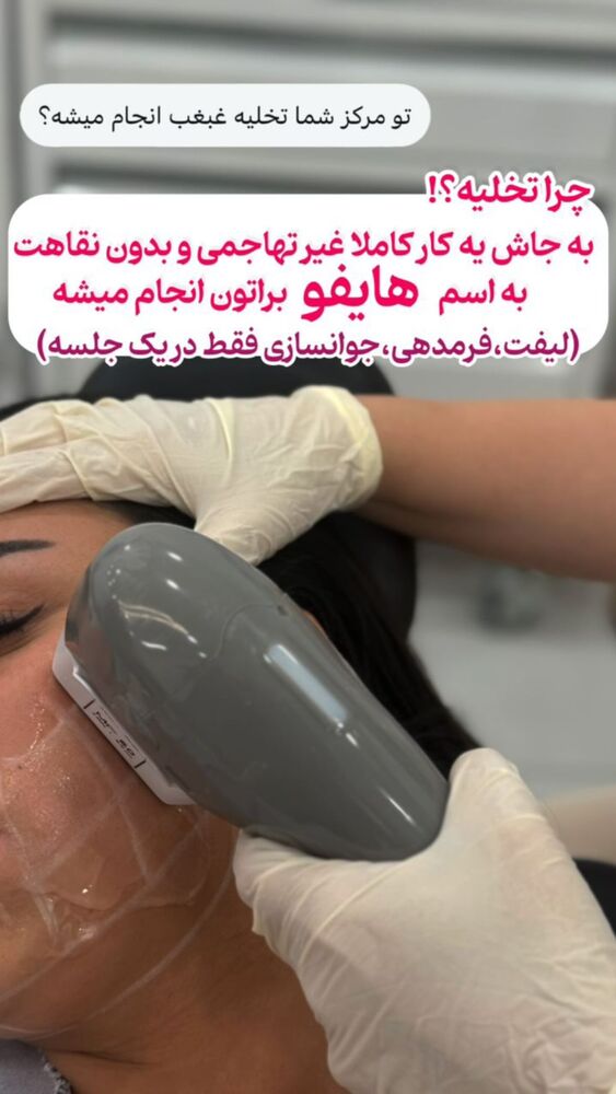  جدید ترین استوری اینستاگرام الناز شمی