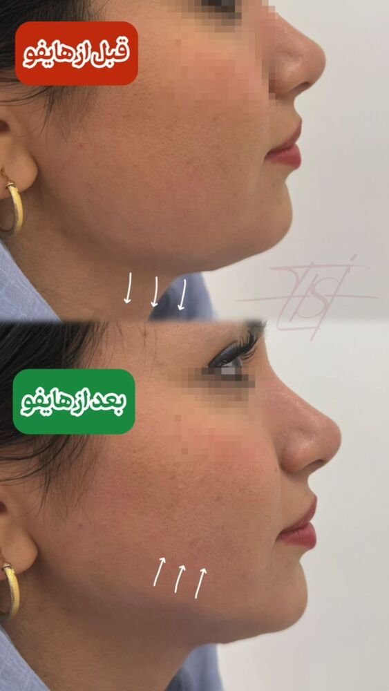  جدید ترین استوری اینستاگرام الناز شمی