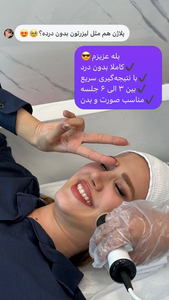  جدید ترین استوری اینستاگرام الناز شمی