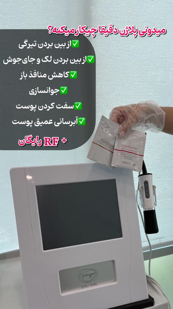  جدید ترین استوری اینستاگرام الناز شمی