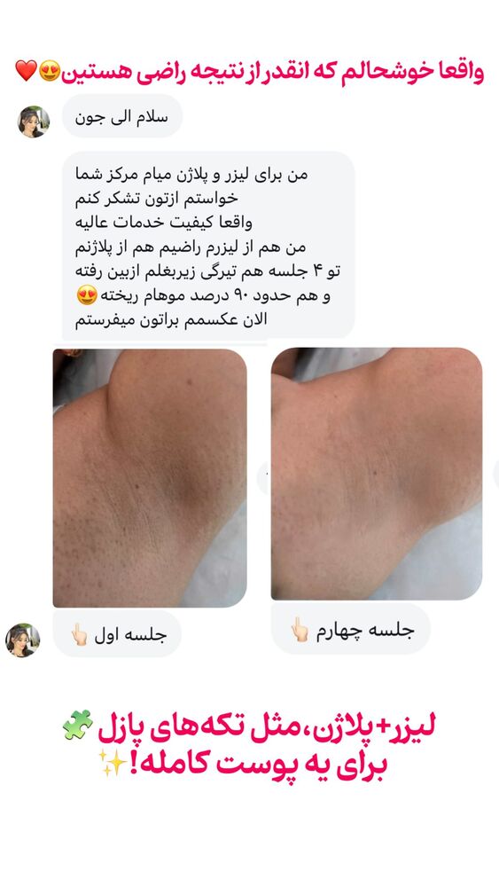  جدید ترین استوری اینستاگرام الناز شمی