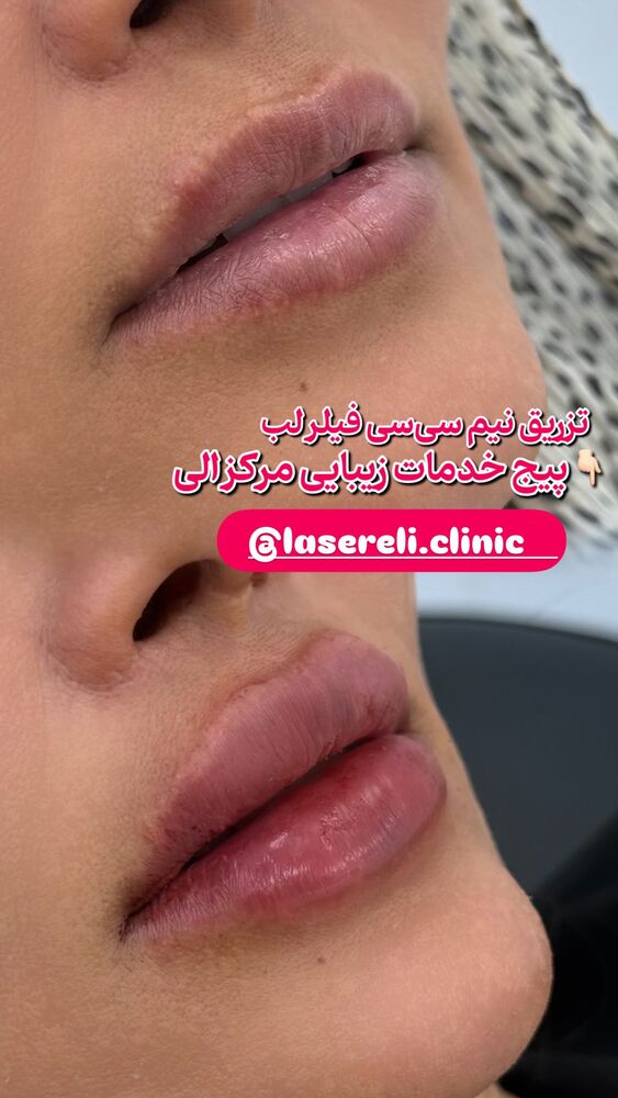  جدید ترین استوری اینستاگرام الناز شمی