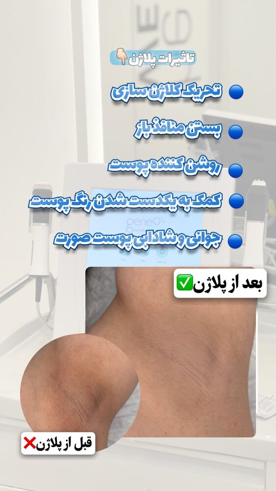  جدید ترین استوری اینستاگرام الناز شمی