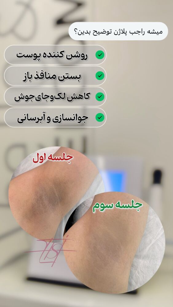  جدید ترین استوری اینستاگرام الناز شمی