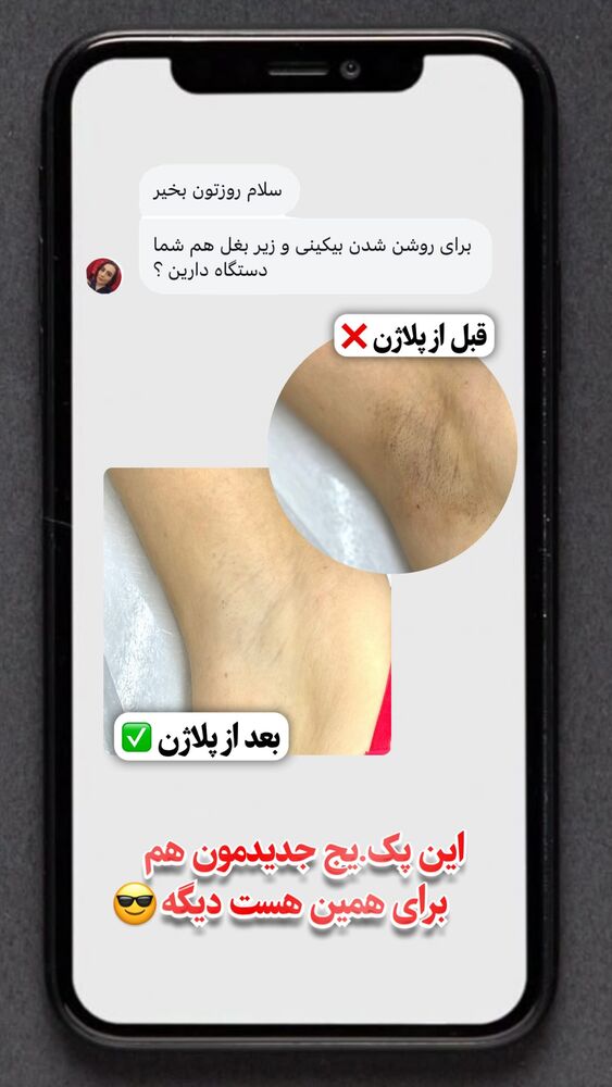 جدید ترین استوری اینستاگرام الناز شمی