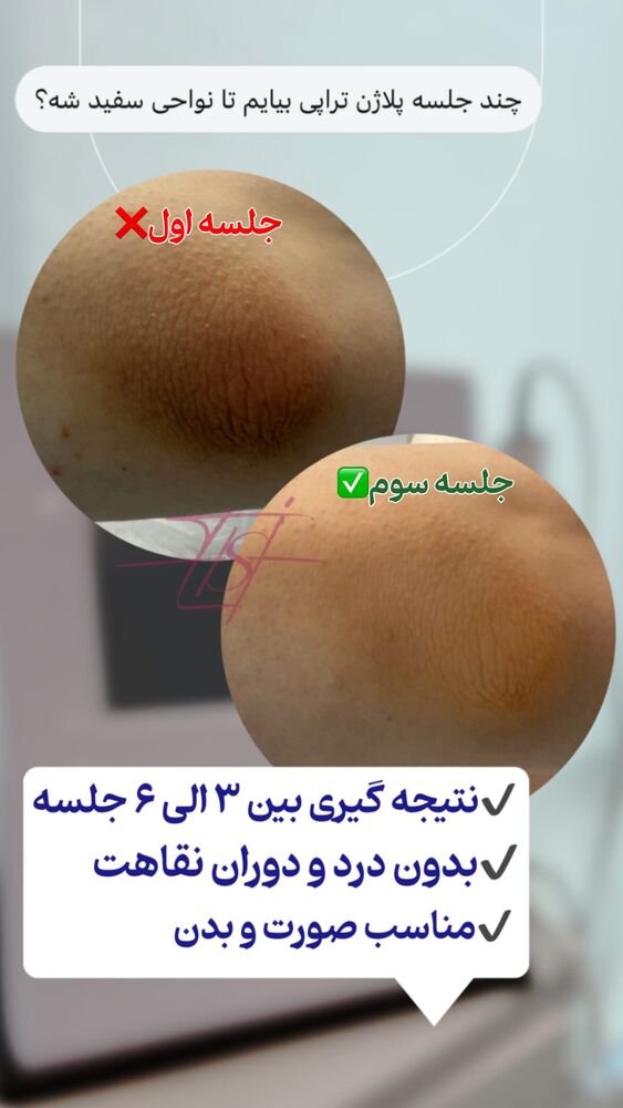  جدید ترین استوری اینستاگرام الناز شمی