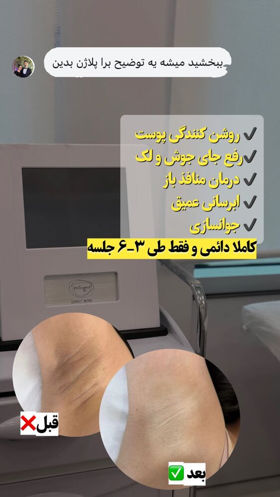  جدید ترین استوری اینستاگرام الناز شمی