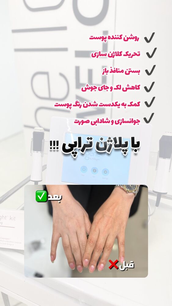  جدید ترین استوری اینستاگرام الناز شمی
