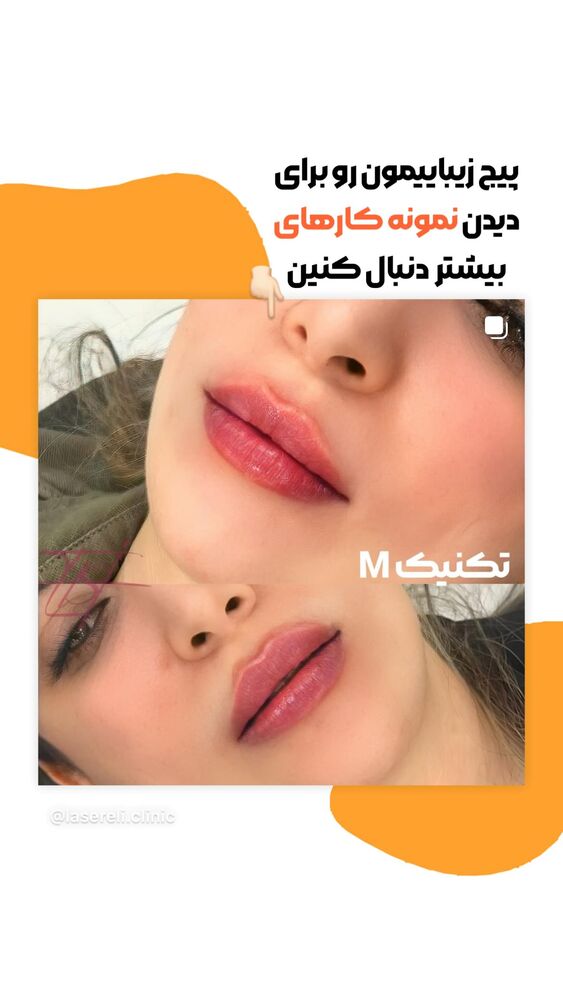  جدید ترین استوری اینستاگرام الناز شمی