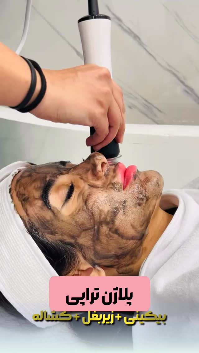  جدید ترین استوری اینستاگرام الناز شمی