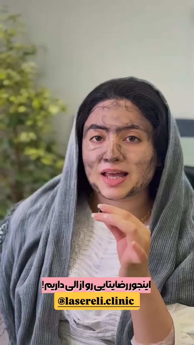  جدید ترین استوری اینستاگرام الناز شمی