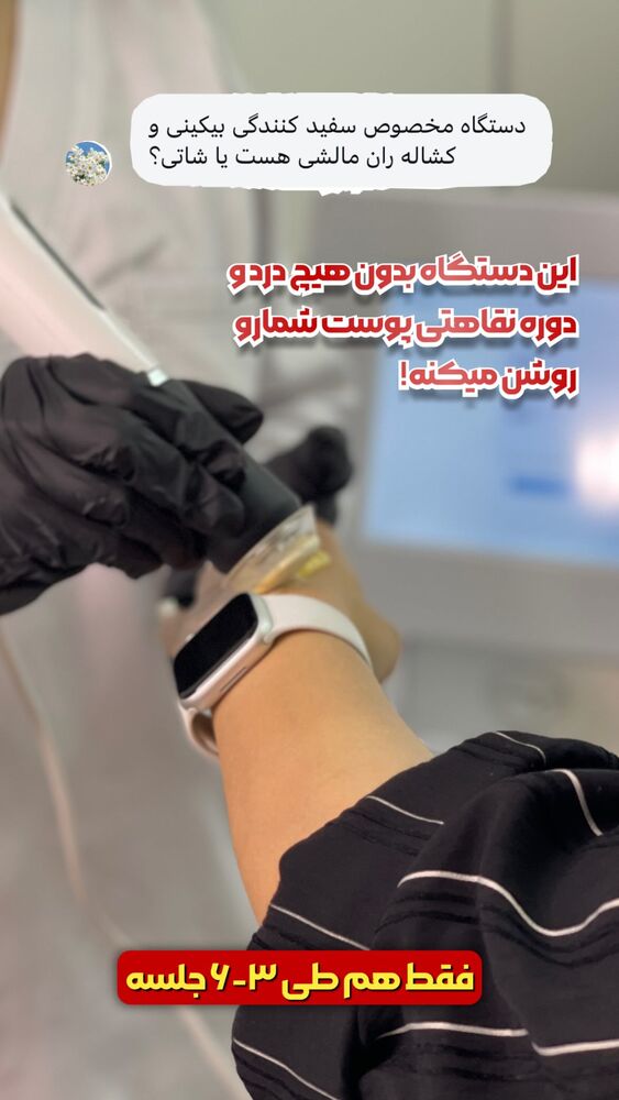  جدید ترین استوری اینستاگرام الناز شمی