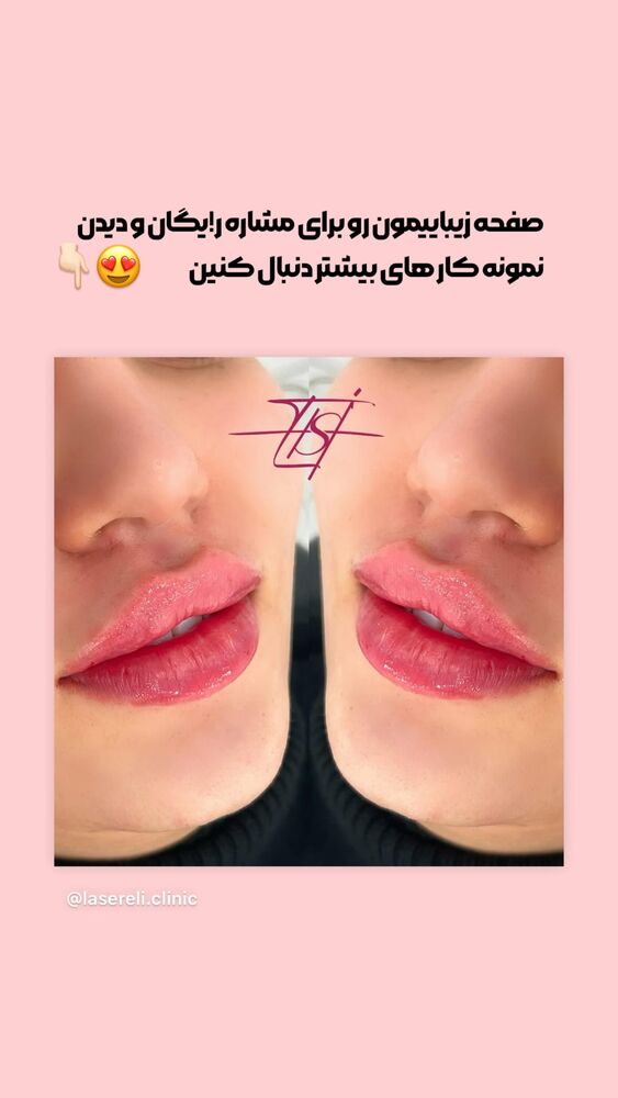  جدید ترین استوری اینستاگرام الناز شمی