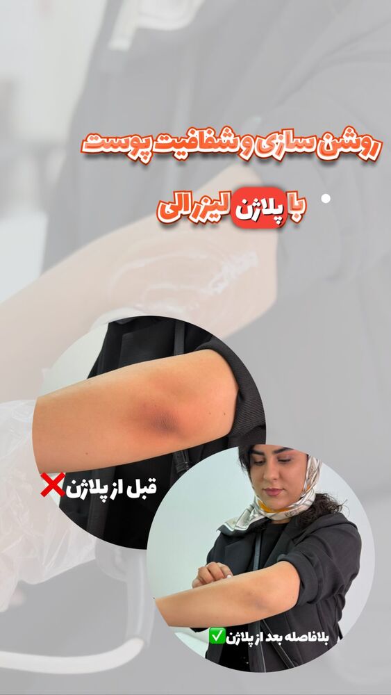  جدید ترین استوری اینستاگرام الناز شمی