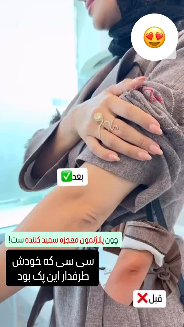  جدید ترین استوری اینستاگرام الناز شمی
