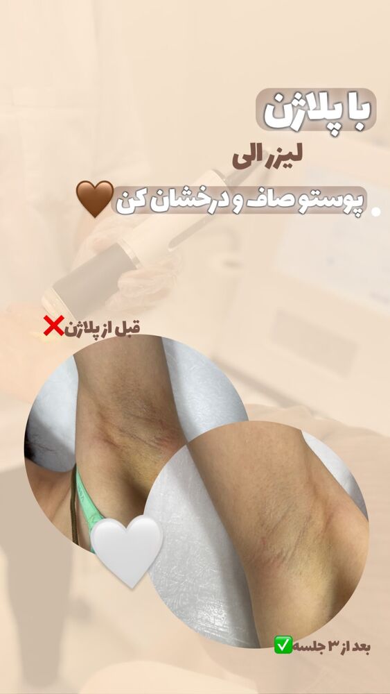  جدید ترین استوری اینستاگرام الناز شمی