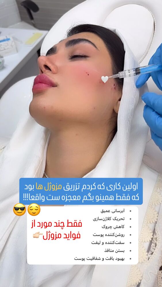  جدید ترین استوری اینستاگرام الناز شمی