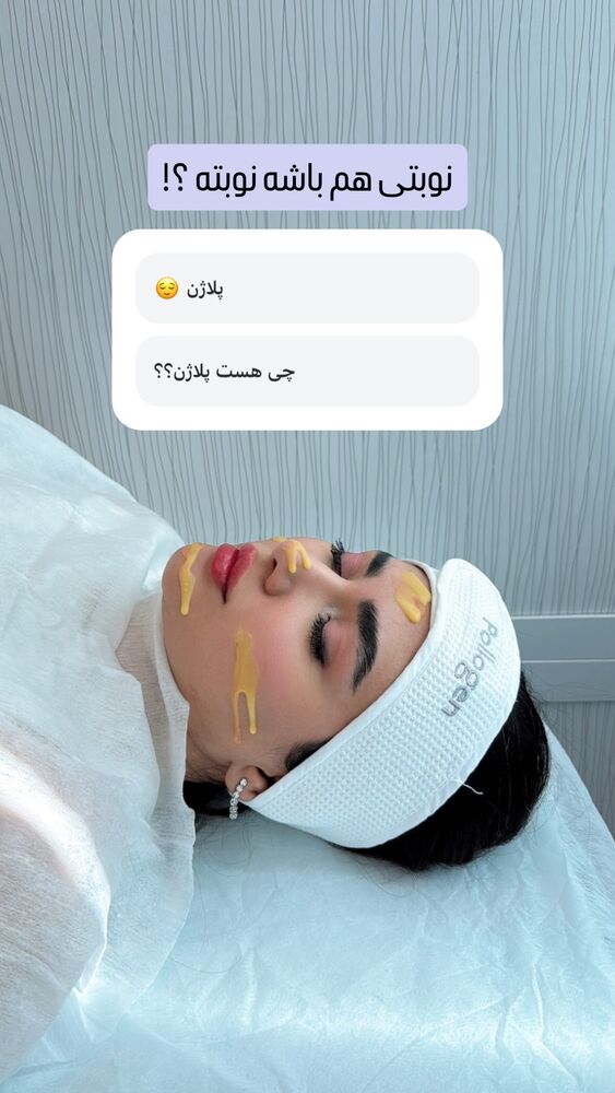  جدید ترین استوری اینستاگرام الناز شمی